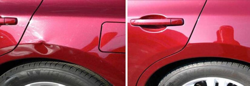 Dent Removal